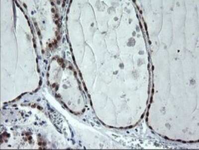 Immunohistochemistry: CMP kinase Antibody (OTI1A1) [NBP2-46313]