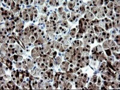 Immunohistochemistry: CMP kinase Antibody (OTI1A1) [NBP2-46313]
