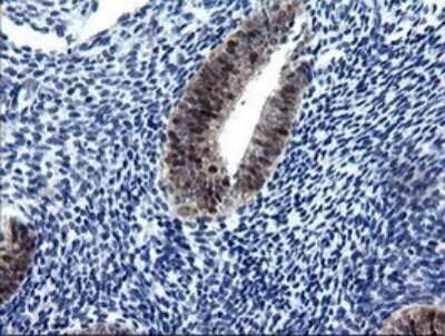 Immunohistochemistry: CMP kinase Antibody (OTI1A1) [NBP2-46313]