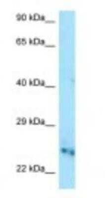 Western Blot: CMP kinase Antibody [NBP1-98367]