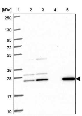 Western Blot: CMP kinase Antibody [NBP2-33692]