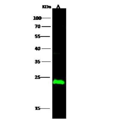 Western Blot: CMP kinase Antibody [NBP3-00262]