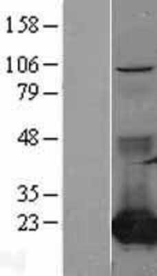 Western Blot: CMP kinase Overexpression Lysate [NBL1-09298]