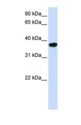 Western Blot: ICMT Antibody [NBP1-69579]