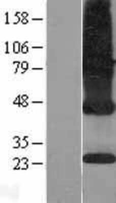 Western Blot: ICMT Overexpression Lysate [NBP2-10353]