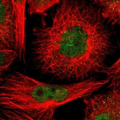 Immunocytochemistry/ Immunofluorescence: CMTM1 Antibody [NBP1-84459]