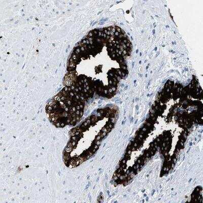 Immunohistochemistry-Paraffin: CMTM1 Antibody [NBP1-84458]