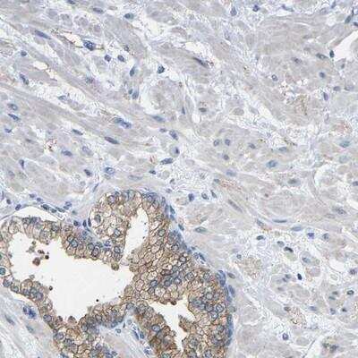 Immunohistochemistry-Paraffin: CMTM1 Antibody [NBP1-84459]