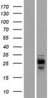 Western Blot: CMTM1 Overexpression Lysate [NBP2-04937]