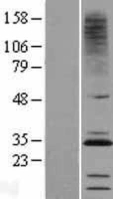 Western Blot: CMTM2 Overexpression Lysate [NBL1-09299]