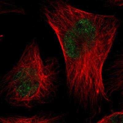 Immunocytochemistry/ Immunofluorescence: CMTM3 Antibody [NBP1-88563]