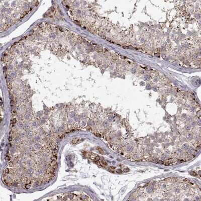 Immunohistochemistry-Paraffin: CMTM3 Antibody [NBP2-68944]