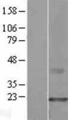 Western Blot: CMTM3 Overexpression Lysate [NBP2-09977]