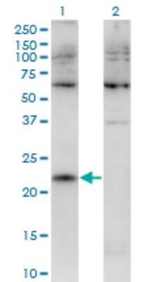 Western Blot: CMTM4 Antibody (1B9) [H00146223-M02]