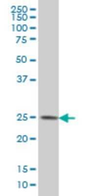 Western Blot: CMTM4 Antibody (6G4) [H00146223-M01]