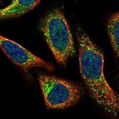 Immunocytochemistry/ Immunofluorescence: CMTM4 Antibody [NBP1-84456]