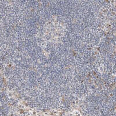 Immunohistochemistry-Paraffin: CMTM4 Antibody [NBP1-84456]