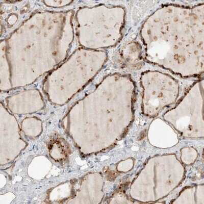 Immunohistochemistry-Paraffin: CMTM4 Antibody [NBP1-84456]