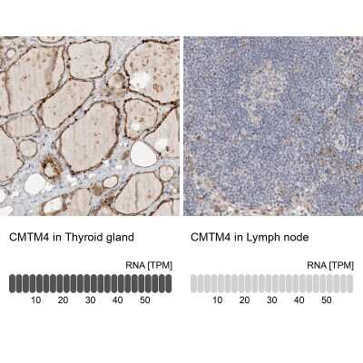 Immunohistochemistry-Paraffin: CMTM4 Antibody [NBP1-84456]