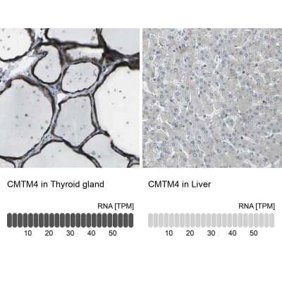 Immunohistochemistry-Paraffin: CMTM4 Antibody [NBP1-84457]