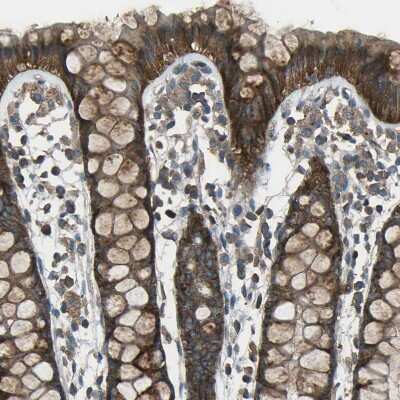 Immunohistochemistry-Paraffin: CMTM4 Antibody [NBP1-84457]
