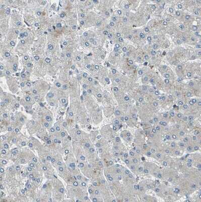 Immunohistochemistry-Paraffin: CMTM4 Antibody [NBP1-84457]