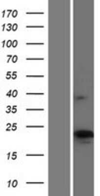 Western Blot: CMTM4 Overexpression Lysate [NBP2-04904]