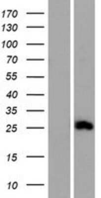 Western Blot: CMTM4 Overexpression Lysate [NBP2-04934]