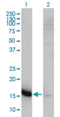 Western Blot: CMTM5 Antibody (2G1-6B10) [H00116173-M01]