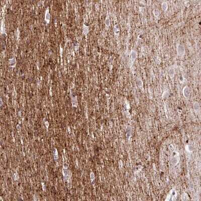Immunohistochemistry: CMTM5 Antibody [NBP2-47503]