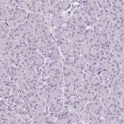 Immunohistochemistry-Paraffin: CMTM5 Antibody [NBP2-47503]
