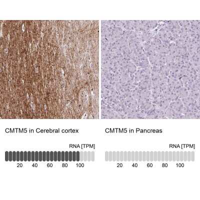 Immunohistochemistry-Paraffin: CMTM5 Antibody [NBP2-47503]