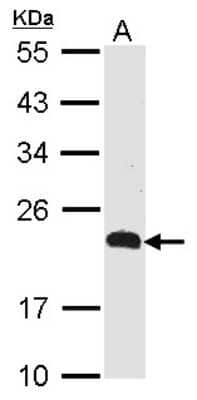 Western Blot: CMTM5 Antibody [NBP1-31149]