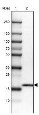 Western Blot: CMTM5 Antibody [NBP2-47503]