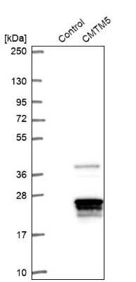 Western Blot: CMTM5 Antibody [NBP2-47503]