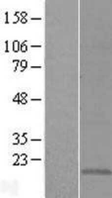 Western Blot: CMTM5 Overexpression Lysate [NBL1-09302]