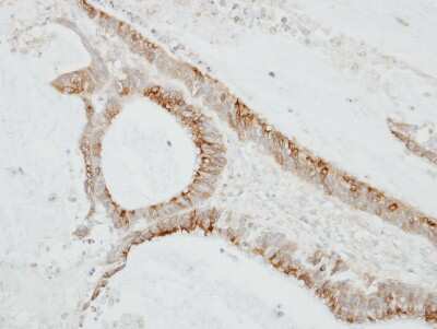 Immunohistochemistry-Paraffin: CMTM6 Antibody [NBP1-31183]