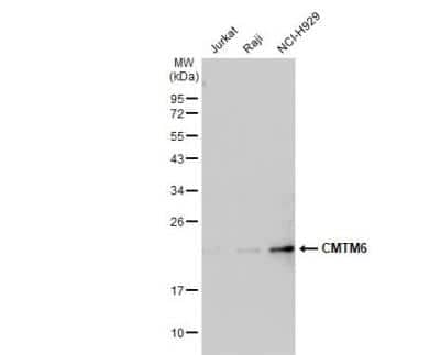 Western Blot: CMTM6 Antibody [NBP1-31183]