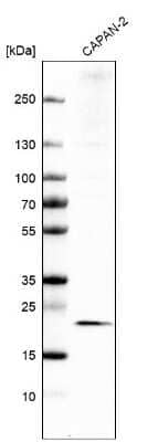 Western Blot: CMTM6 Antibody [NBP1-85590]