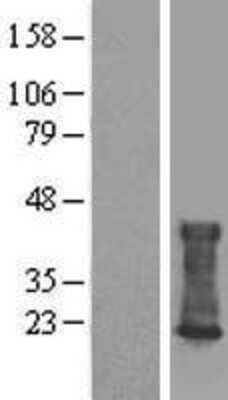 Western Blot: CMTM6 Overexpression Lysate [NBL1-09303]