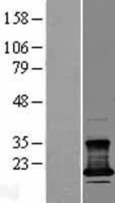 Western Blot: CMTM7 Overexpression Lysate [NBL1-09304]