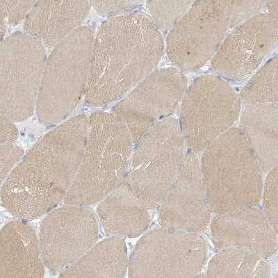 Immunohistochemistry-Paraffin: CMYA3 Antibody [NBP1-88066]