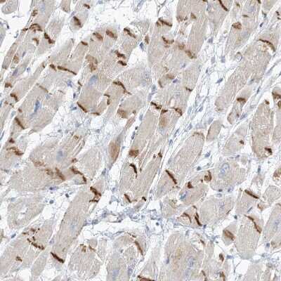 Immunohistochemistry-Paraffin: CMYA3 Antibody [NBP1-88066]