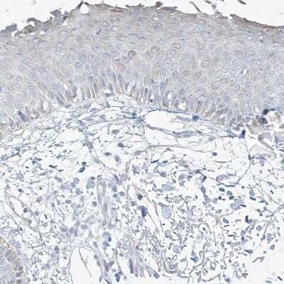 Immunohistochemistry-Paraffin: CMYA3 Antibody [NBP1-88066]