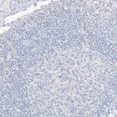 Immunohistochemistry-Paraffin: CMYA3 Antibody [NBP1-88066]