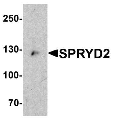 Western Blot: CMYA5 AntibodyBSA Free [NBP1-77117]