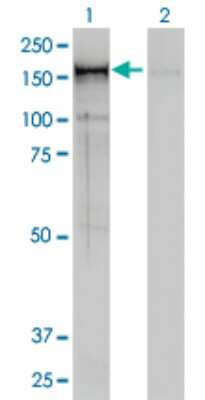 Western Blot: CNAP1 Antibody (4C12) [H00009918-M01]