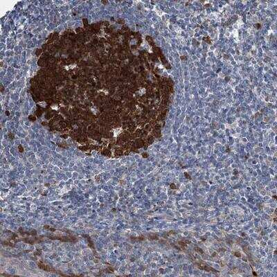 Immunohistochemistry: CNAP1 Antibody [NBP1-88201]