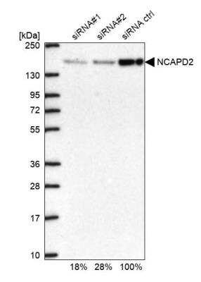 Western Blot: CNAP1 Antibody [NBP1-88201]