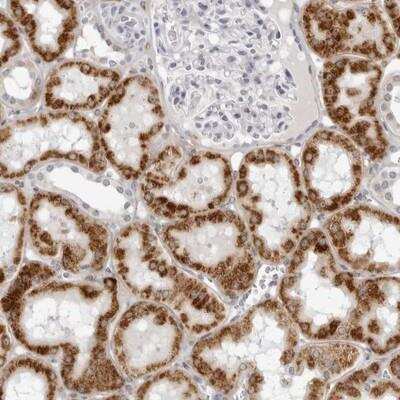 Immunohistochemistry: CNBD1 Antibody [NBP1-93825]